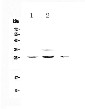Anti-Betacellulin/Btc Antibody