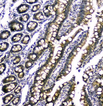 Anti-RAB6A Antibody
