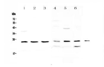 Anti-RAB6A Antibody