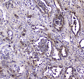 Anti-LGALS3BP Antibody