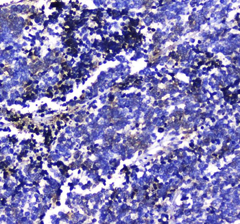 Anti-LGALS3BP Antibody