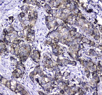 Anti-LGALS3BP Antibody