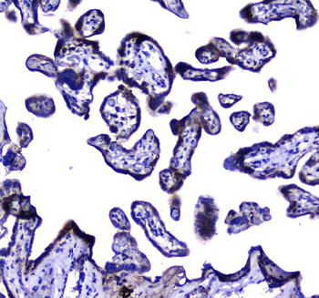 Anti-LGALS3BP Antibody