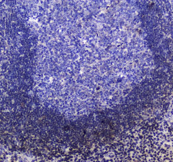SHIP/INPP5D Antibody