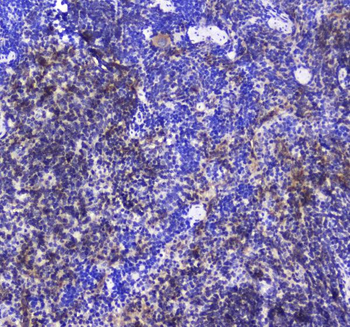 SHIP/INPP5D Antibody