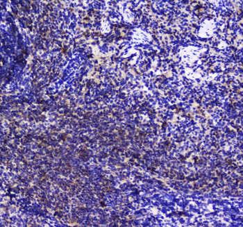SHIP/INPP5D Antibody