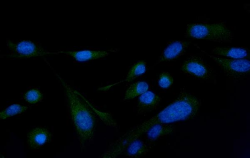Anti-PLCG 2/PLCG2 Antibody