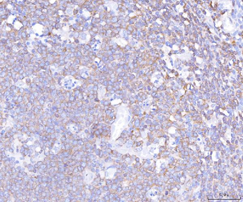 Anti-PLCG 2/PLCG2 Antibody