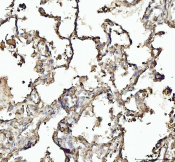 Anti-Annexin VI/ANXA6 Antibody