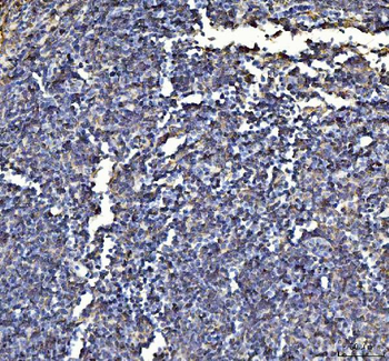 Anti-Annexin VI/ANXA6 Antibody