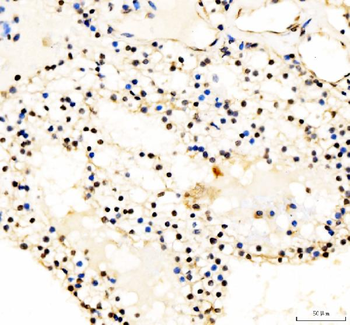 Anti-JunD Antibody