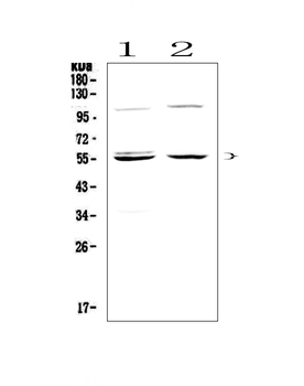 Caspase 8/CASP8 Rabbit Polyclonal Antibody