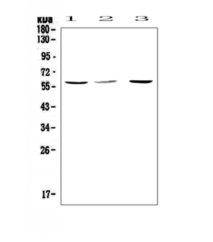 Anti-Caspase 8/CASP8 Antibody