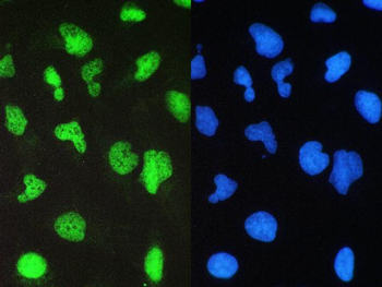 Anti-BRG1/SMARCA4 Antibody