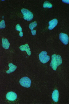 Anti-BRG1/SMARCA4 Antibody