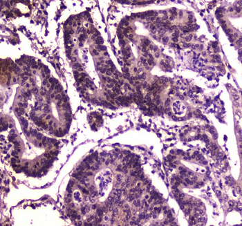 Anti-BRG1/SMARCA4 Antibody