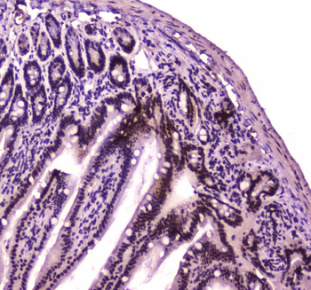 Anti-BRG1/SMARCA4 Antibody
