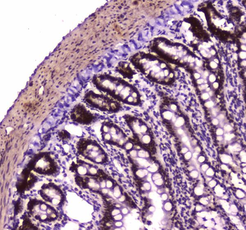 Anti-BRG1/SMARCA4 Antibody