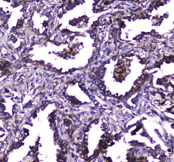 Anti-TLR1 Antibody