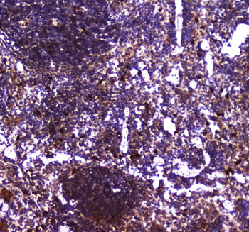 Anti-TLR1 Antibody