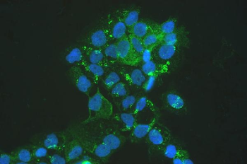 Anti-MVP Antibody