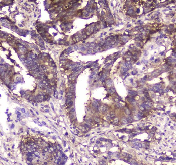 Anti-MVP Antibody