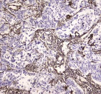 Anti-MVP Antibody