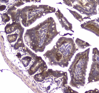Anti-MVP Antibody