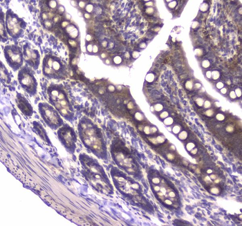 Anti-MVP Antibody