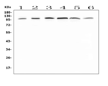 Anti-MVP Antibody