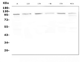 Anti-MVP Antibody