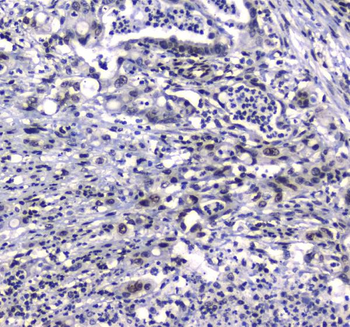 Anti-GFI1 Antibody