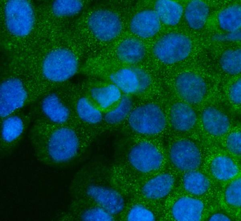 Anti-Mannose 6 Phosphate Receptor (Cation independent)/IGF2R Antibody