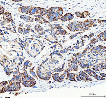 Anti-Mannose 6 Phosphate Receptor (Cation independent)/IGF2R Antibody