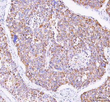 Anti-Mannose 6 Phosphate Receptor (Cation independent)/IGF2R Antibody