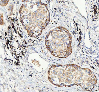 Anti-Mannose 6 Phosphate Receptor (Cation independent)/IGF2R Antibody