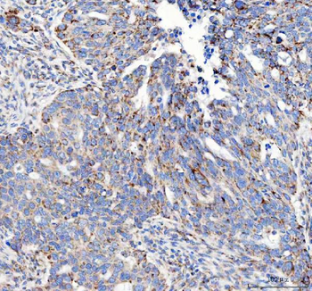 Anti-Mannose 6 Phosphate Receptor (Cation independent)/IGF2R Antibody