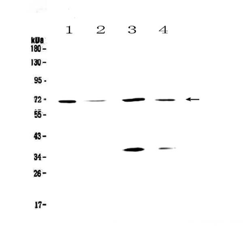 Anti-DNA Polymerase lambda/POLL Antibody