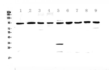 Anti-GNS Antibody