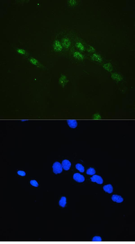 Anti-CBFb Antibody