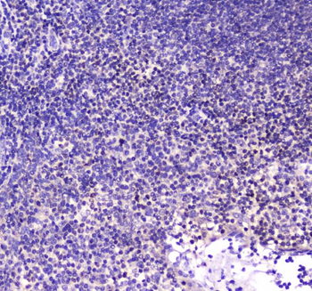 Anti-CBFb Antibody