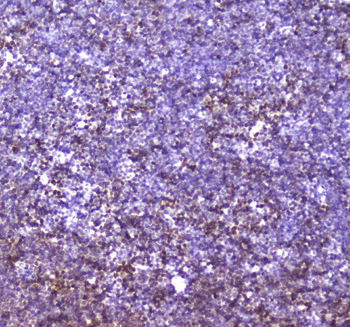 Anti-CBFb Antibody