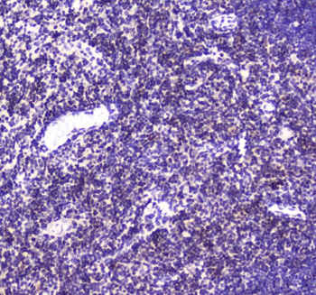 Anti-CBFb Antibody