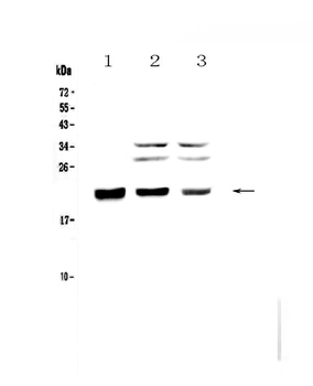 Anti-CBFb Antibody