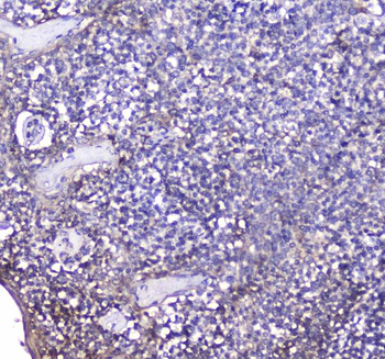 BCMA/TNFRSF17 Antibody