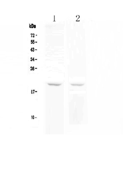 Anti-BCMA/TNFRSF17 Antibody