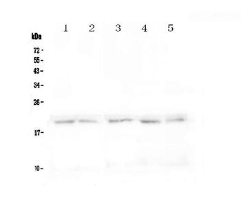 BCMA/Tnfrsf17 Antibody