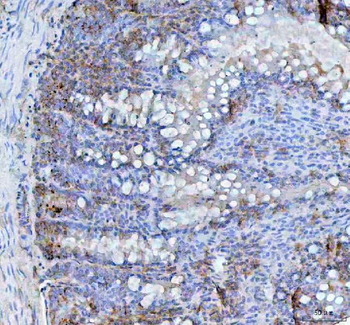 Anti-BCMA/Tnfrsf17 Antibody