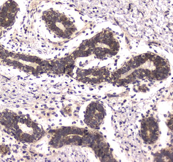 Anti-RNA polymerase II RPB1/POLR2A Antibody