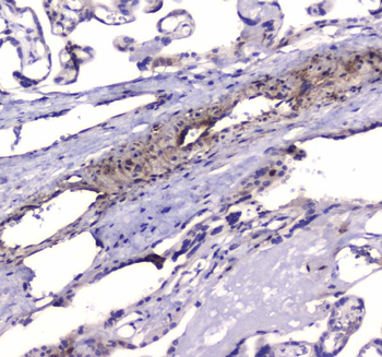 Anti-PDE4D Antibody